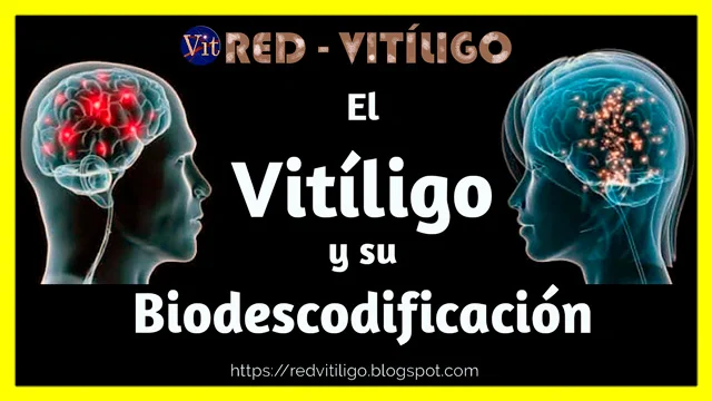 Vitiligo y su Biodescodificación