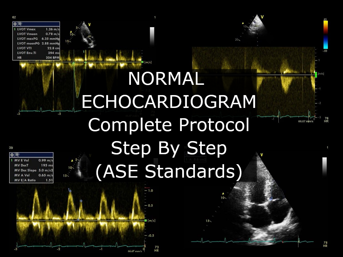 phd in echocardiography uk