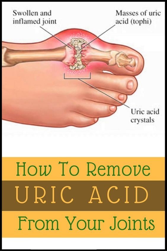 How This Simple Juice Recipe Removes Uric Acid Crystallization In