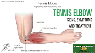 Tennis elbow symptoms Tennis elbow symptoms