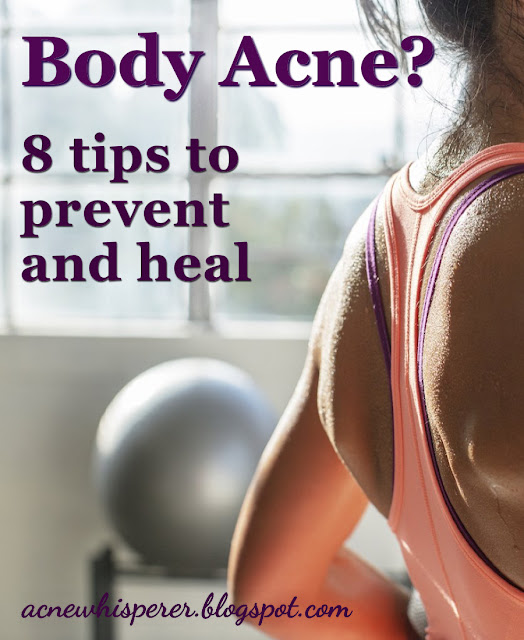 The Acne Whisperer How To Manage Body Acne