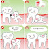 Biểu hiện khi răng khôn hàm trên mọc ngầm? 