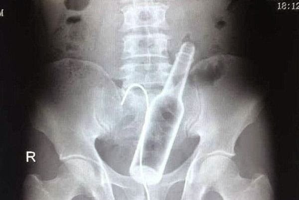 Curiosas y raras radiografías