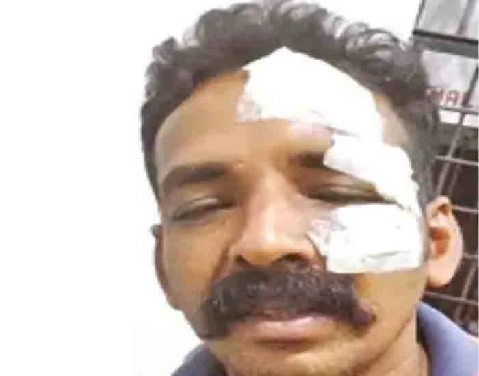 After beating pet dog to death, man went into a relative's house and attack  heart-sick husband, wife and son; Young man arrested, News, Local News, Crime, Criminal Case, Police, Arrested, Court, Remanded, Kerala