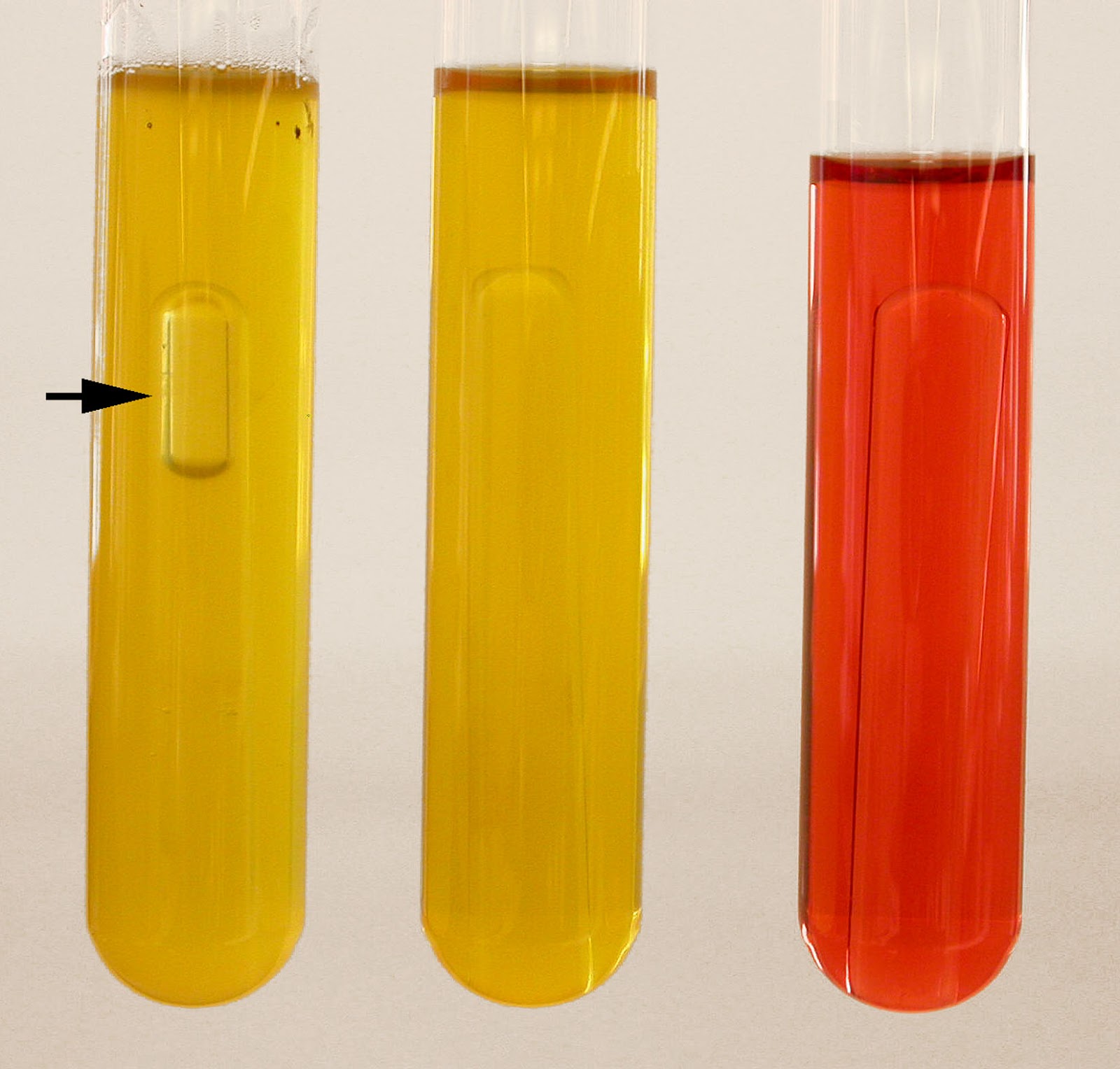 BACTERIA EXAMINATION OF WATER AND VARIOUS TEST