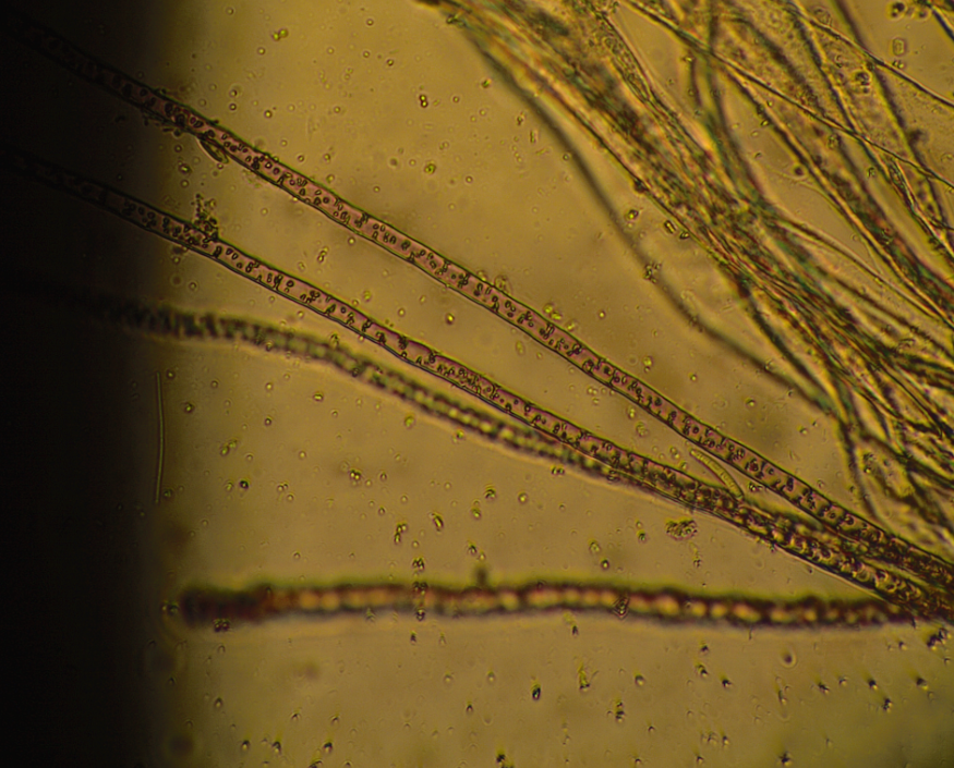 Welcome to the big world of tiny organisms: Specimen #2: Marchantia sp.