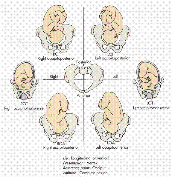 loa presentation in pregnancy