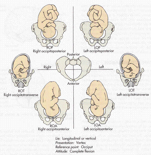 baby presentation positions