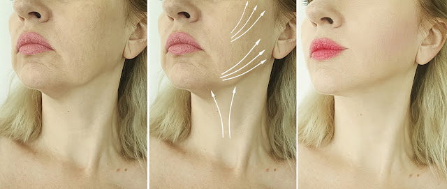 Voici comment utiliser la vitamine C sur le visage pour un effet botox (recette maison)