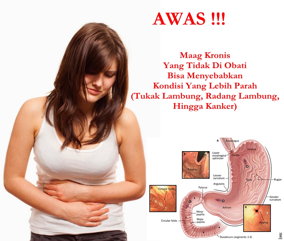 Maag это бывший