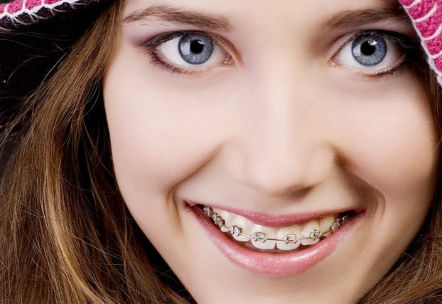 Blog da Odonty Ortodontia