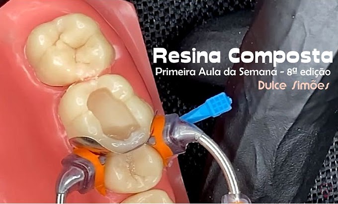 RESINAS COMPOSTAS: Como Restaurar com Perfeição Dentes Posteriores - Primeira Aula - 8ª edição