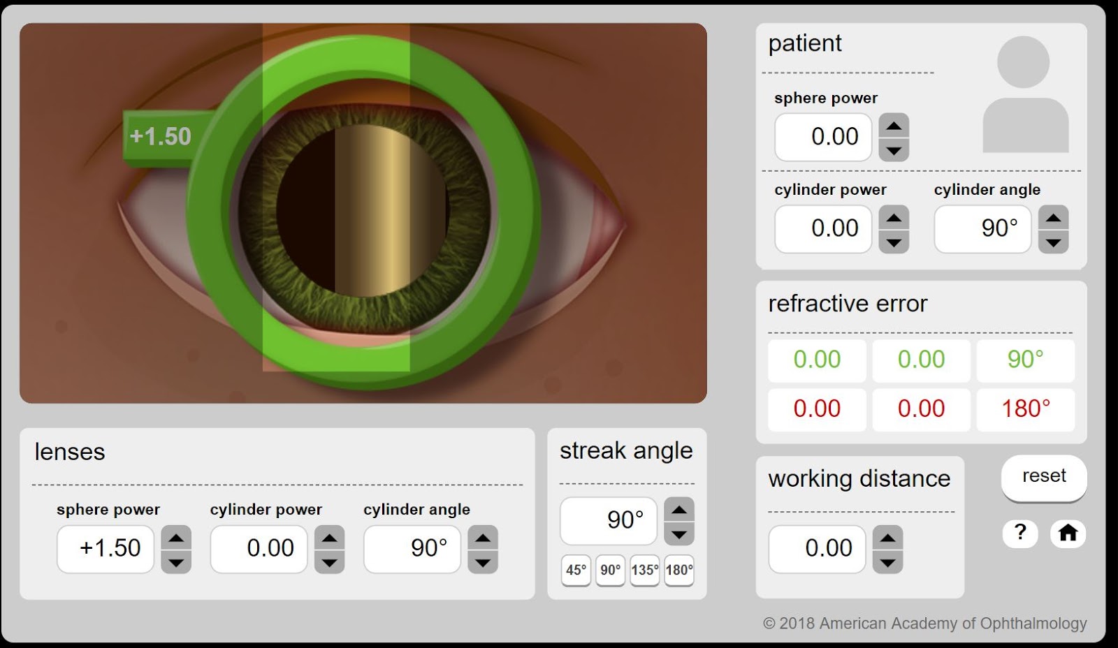 Practice Retinoscopy Online Retinoscopy Simulator Eye Health Nepal