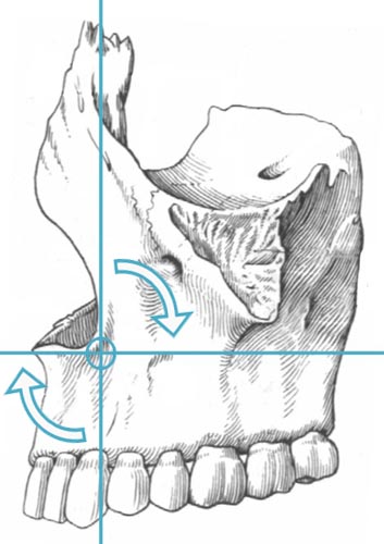 т. движение верхней челюсти. межчелюстная кость у человека. остеотомия челюсти операция. межчелюстное пространство пирогова.