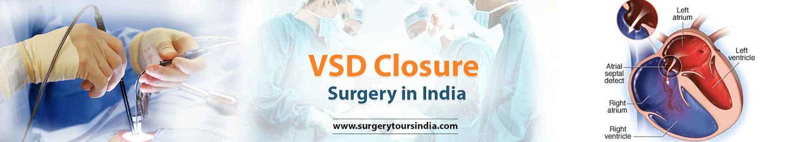 VSD Closure Surgery  India