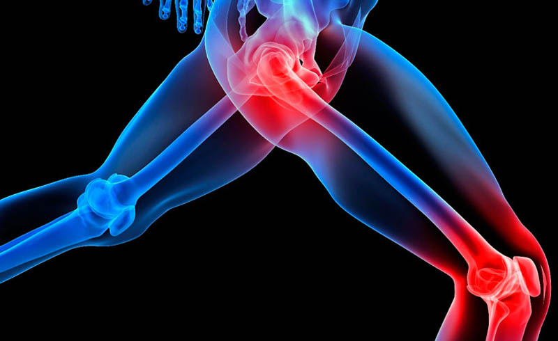 Do you reach for the Ibuprofen when your joint pain first flares up?