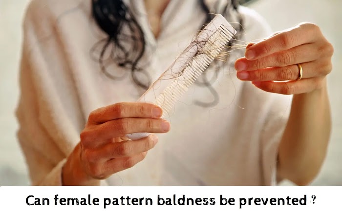Can female pattern baldness be prevented?