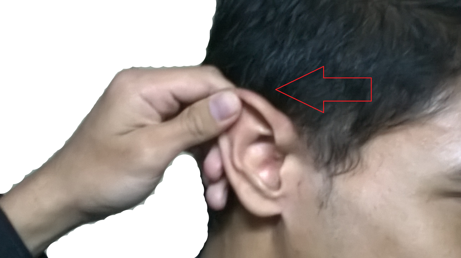 PERFORMING OTOSCOPIC EXAMINATION AUDIOLOGIS