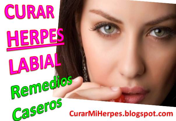 Como-Quitar-Un-Fuego-Labial-Remedios-Caseros-Como-Curar-Herpes-Labios-Bucal