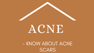 Know About Acne