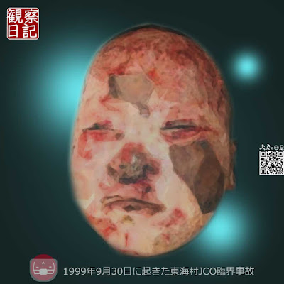 東海村JCO臨界事故の被害者の顔。忘れない為にイラスト化して少し生々しさを弱らげて載せてます。