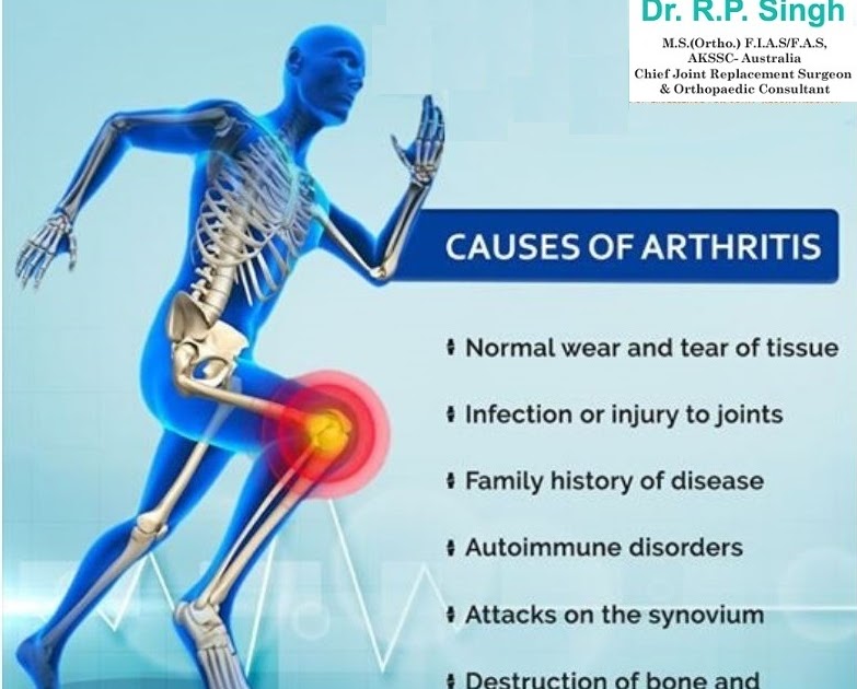 Knee & Hip Joints Replacement Surgeon in Bhopal Dr. RP Singh Tips To