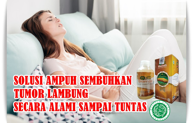 Obat Tumor Lambung