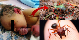 HEART-BREAKING! 3-day-old Abandoned Baby, Eaten alive by Ants in a Forest HEART-BREAKING! 3-day-old Abandoned Baby, Eaten alive by Ants in a Forest