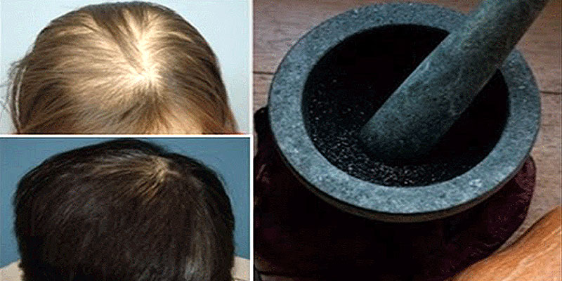 How To Grow Thick Healthy Hair Fast And Stop Hair Fall Permanently