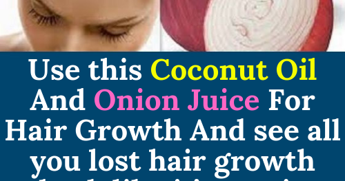 Let Start Slim Today: Use this Coconut Oil And Onion Juice ...