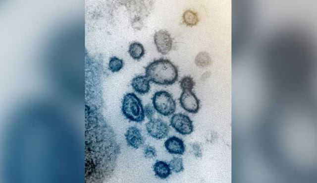 10 VIRUS PALING MEMATIKAN DI DUNIA