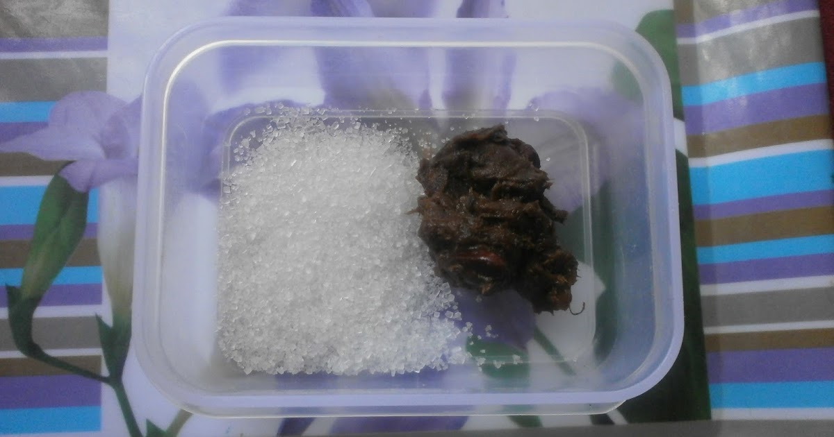 Cara Nak Hilangkan Sakit Tekak / fikah mus Petua Nak Hilangkan Sakit