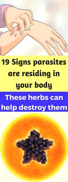 19 Signs parasites are residing in your body-These herbs can help destroy them