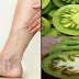 VARICOSE VEINS: How To Treat Varicose Veins Using Green Tomatoes