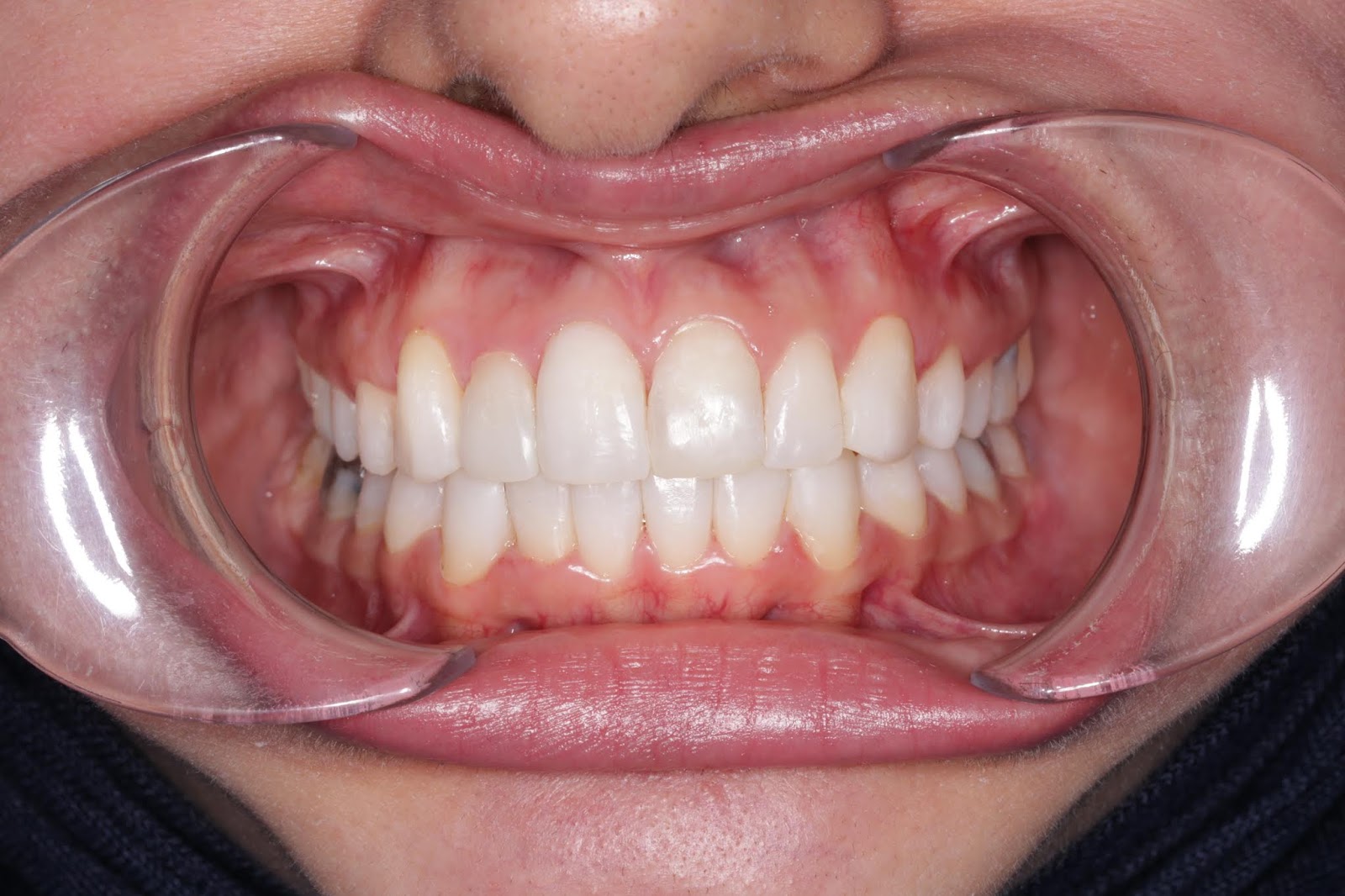 E. BardawilOrthodontistInvisalign Diamond level