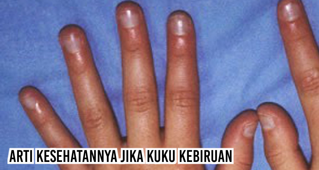 Ternyata Bentuk Dan Warna Kuku Menunjukkan Kesehatanmu Barang Promosi Mug Promosi Payung Promosi Pulpen Promosi Jam Promosi Topi Promosi Tali Nametag