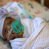 Americana que nasceu com 244 gramas é o menor bebê do mundo a sobreviver