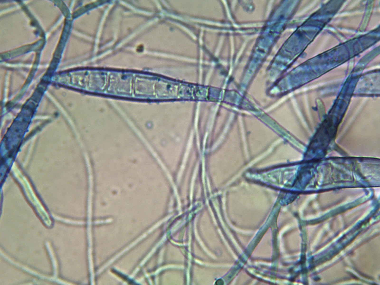 Нити мицелия споры. Trichophyton микроскопия. Трихофития и микроспория под микроскопом. Микроспория трихоскопия. Микроспорум Канис микроскопия.