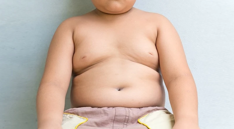 Obez çocuk sayısı hızla artıyor!
