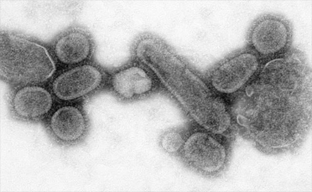 Рисунок 8. Электронная микрофотография воссозданного вируса H1N1, вызвавшего эпидемию в 1918 г.