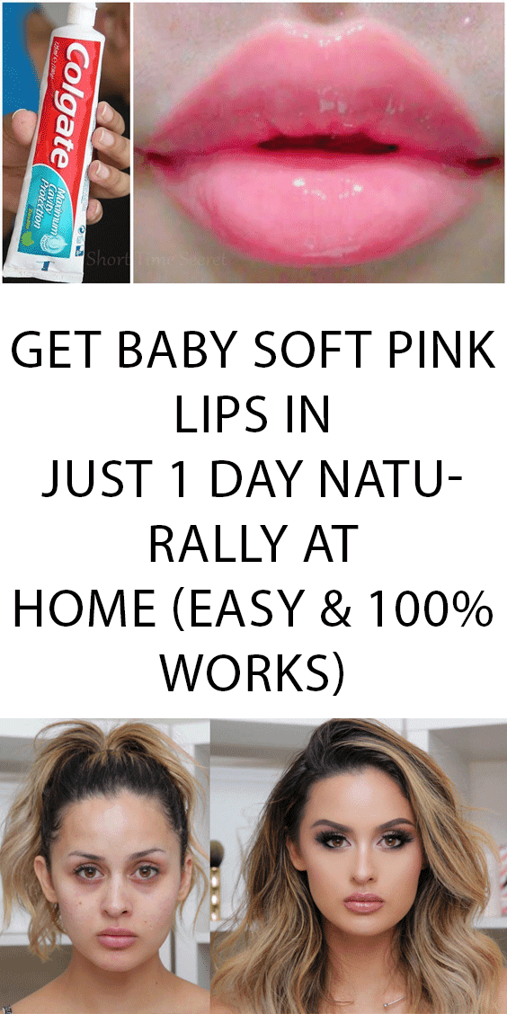Get Baby Soft Pink Lips in just 1 Day Naturally at Home (Easy & 100 Works)