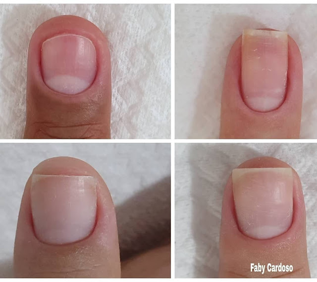 Appliquez le vinaigre de cidre si vous voulez fortifier les ongles rapidement