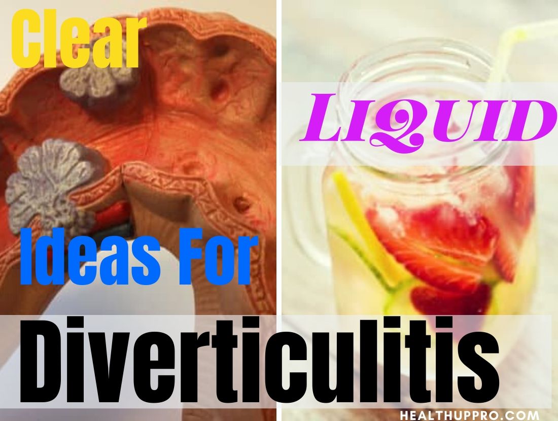 Clear Liquid Diet Ideas For Diverticulitis