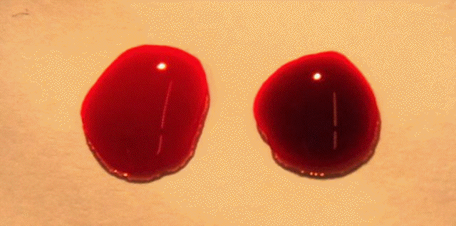 color de la sangre venosa