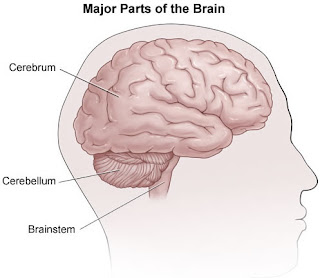 brain stem stroke brain stem stroke