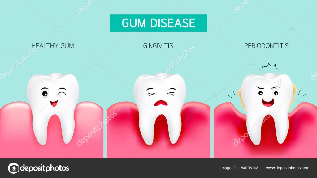 PRINCIPALES PROBLEMAS DE SALUD ORAL CARIES DENTAL, GINGIVITIS Y