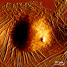 Living fibroblast cell image obtained by AFM Living fibroblast cell image obtained by AFM