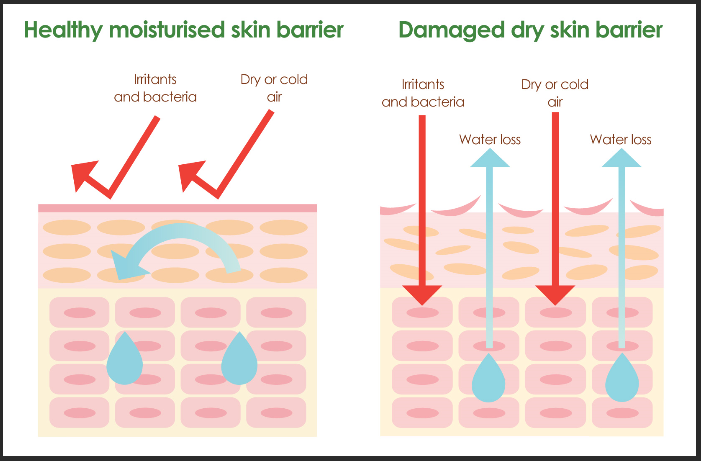 Skin barrier adalah