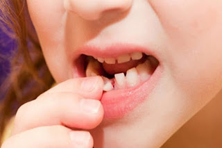Trẻ em thay bao nhiêu cái răng-1