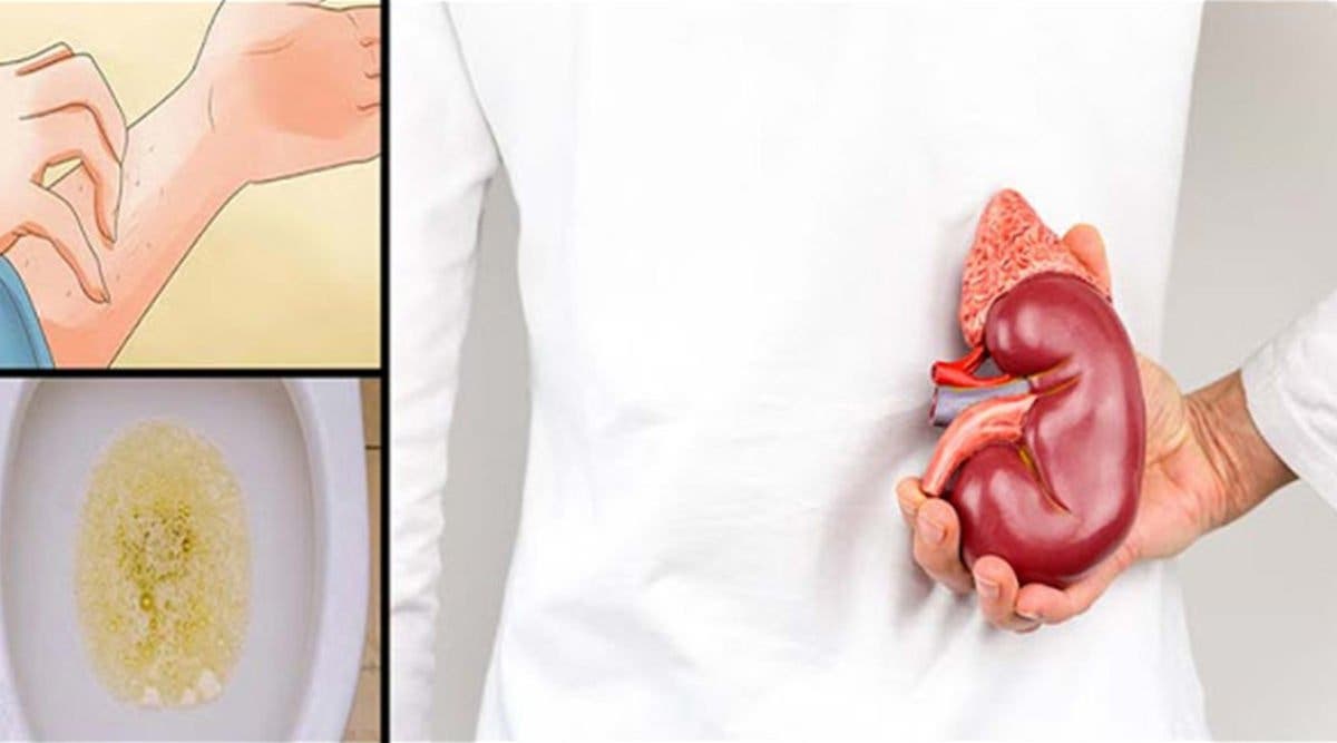 A Damaged Kidney Makes You Sick And Unhealthy: 5 Symptoms To Identify